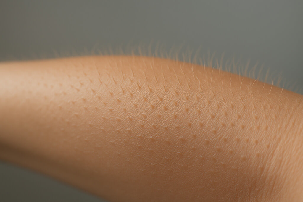 brazo con piel de gallina